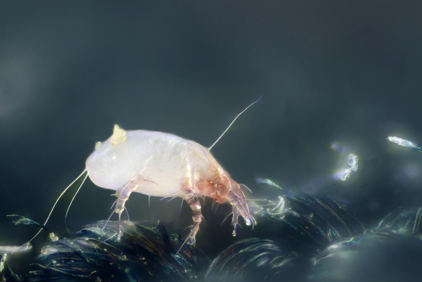 Micrograph of a house-dust-mite, a common indoor allergen trigger of allergic asthma.